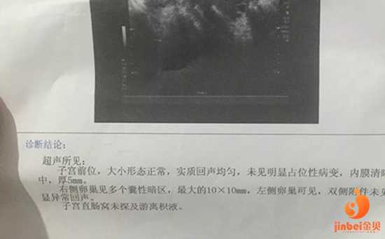 广州供卵成功率会|【广州哪家医院可以做供卵试管婴儿】医生询问以前有没有